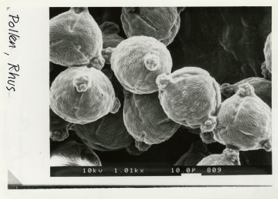 Scanning Electron Microscope (SEM) research - SEM photo: pollen from Rhus